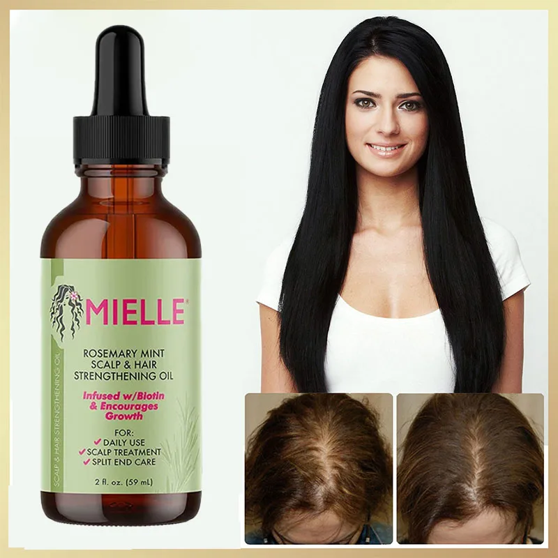 Description Picture 6 of itemMielle Organics Rosemary Mint Scalp And Hair Enhancement Oil Containing Biotin And Essential Oils Nourishes Split And Dry Scalp