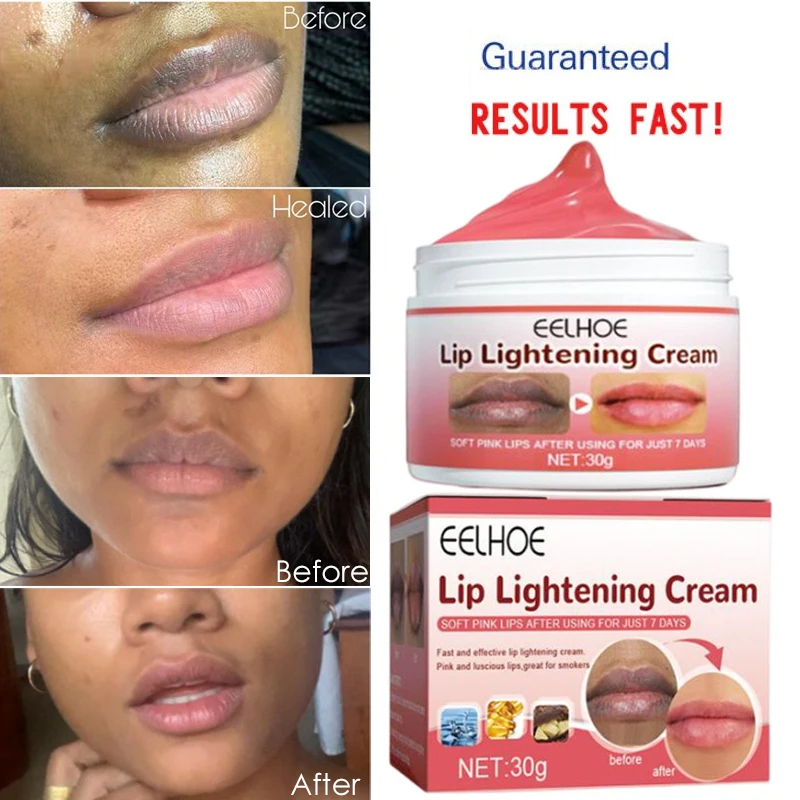

Lips Pink Fresh Lightening Bleaching Cream Treatment Remove Dark Moisturizing Hydrating Lighten Bleaching Corner Of Mouth Care