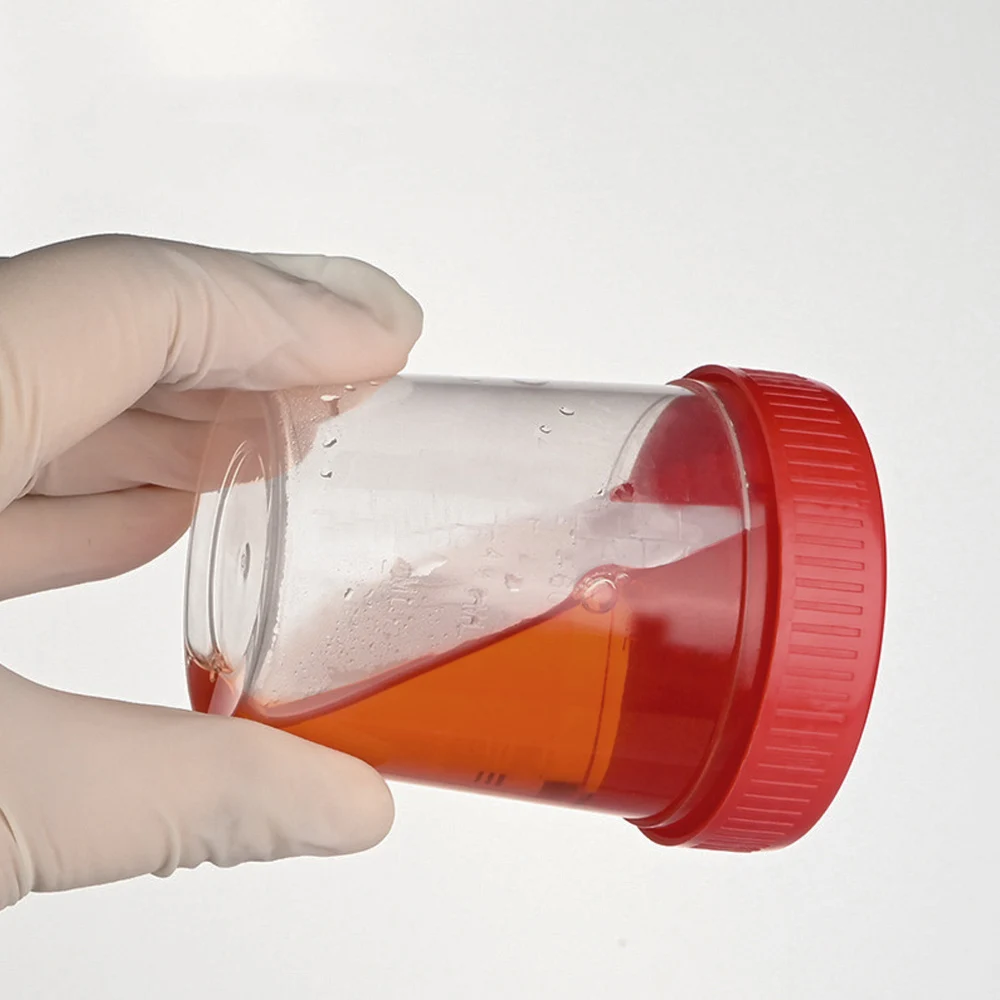 5pcs 60ml Urine Collection Sample Cup Specimen Bottle Container 60ML Plastic Cup Container for Use