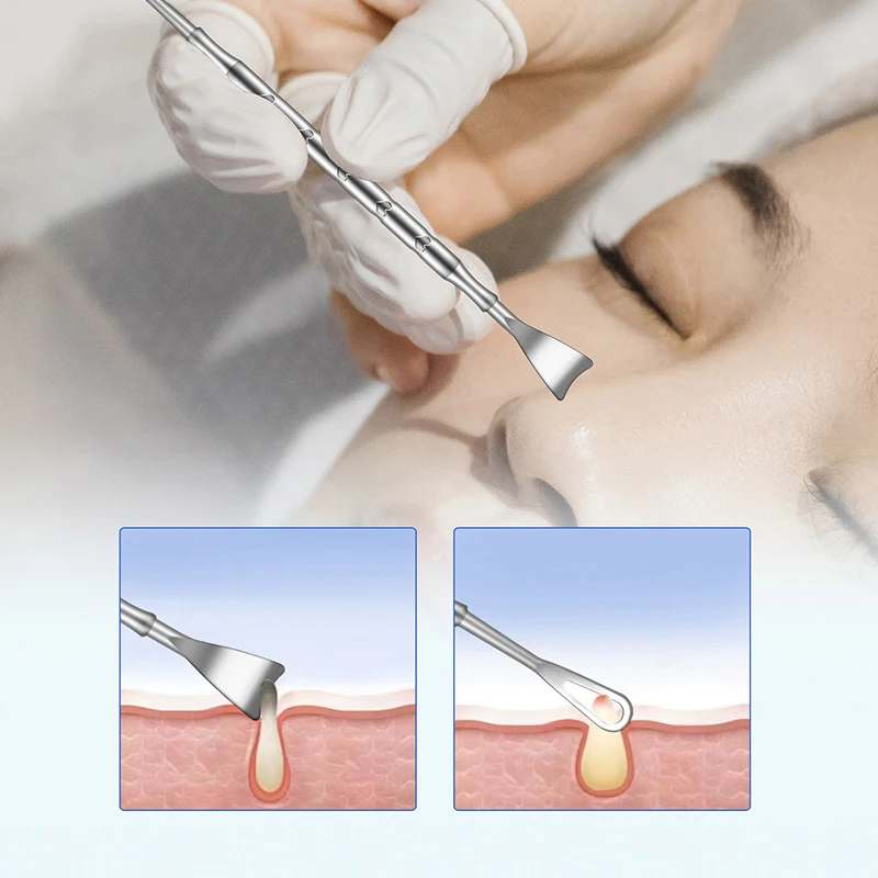 2 In 1 Pimple Popper Tool Blackhead Remover Acne Needle Removing Treatment Whitehead Popping Zit Nose Face Blemish Extractor blackhead remover acne remover