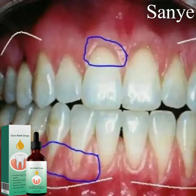 Quick Repair of Cavities Caries Mousse Teeth Remove Yellow Plaque Stains Whiten Serum Relieve Gums Decay Toothache Clean Essence quick repair of cavities caries mousse teeth remove yellow plaque stains whiten serum relieve gums decay toothache clean essence