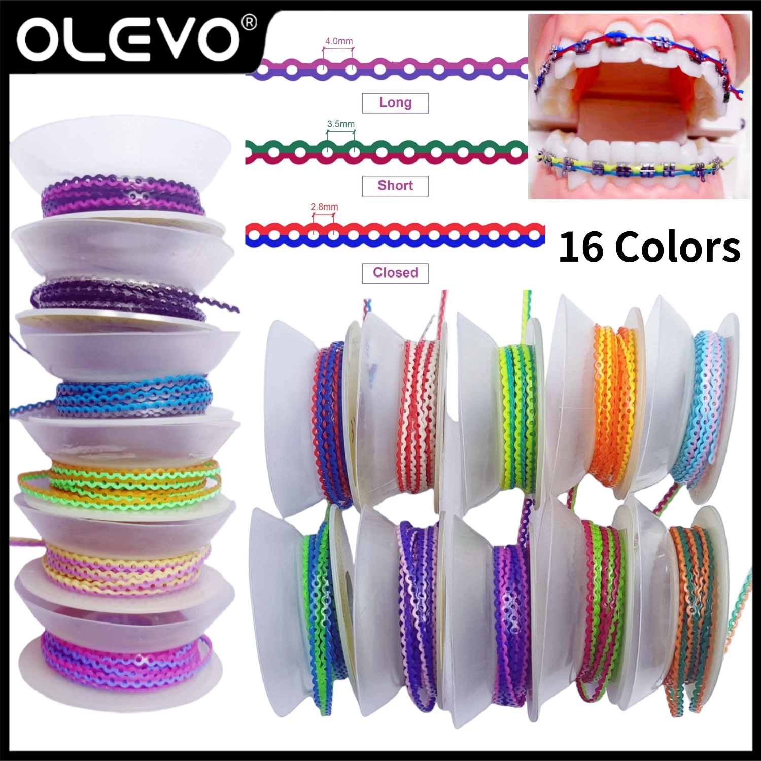 15 футов/рулон, Ортодонтическая