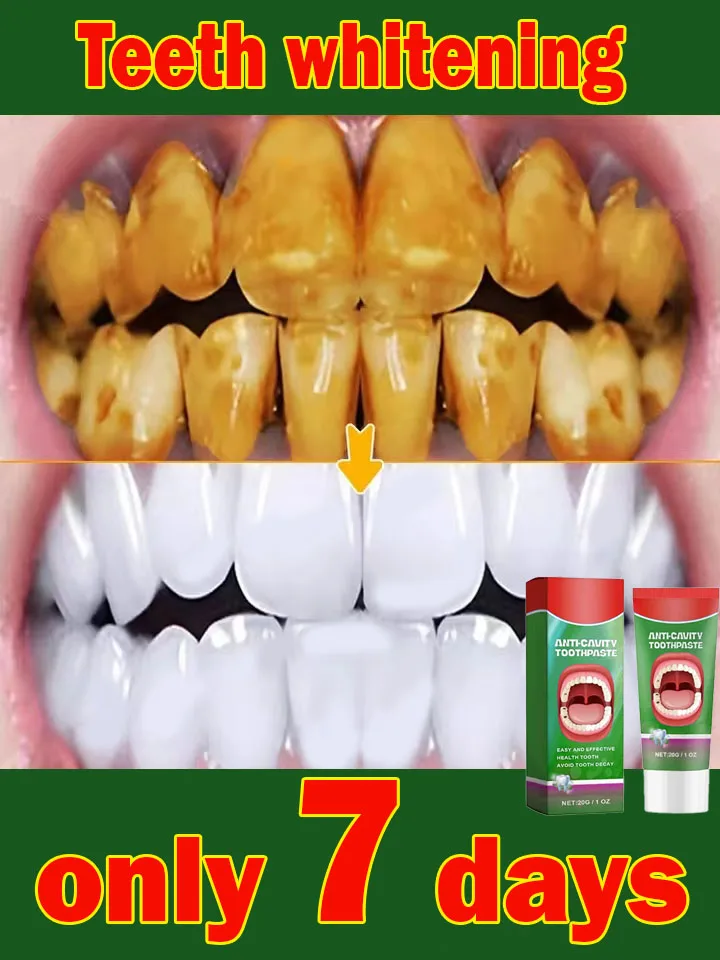 S&eacute;rum r&eacute;parateur de gencives rines, dentifrice, allergie dentaire,