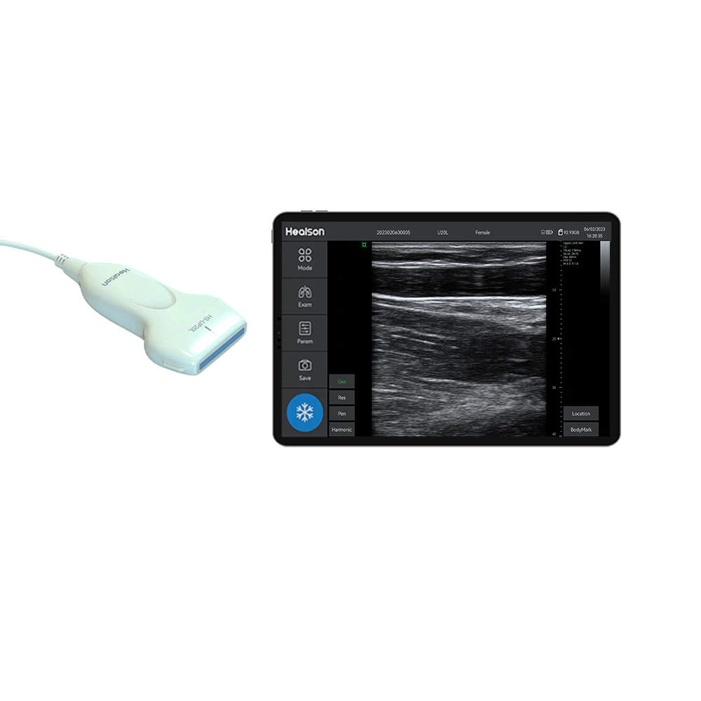 Portable B/W Handheld Linear Scanner Ultrasound Probe Medical Instruments with Android Tablet Computer