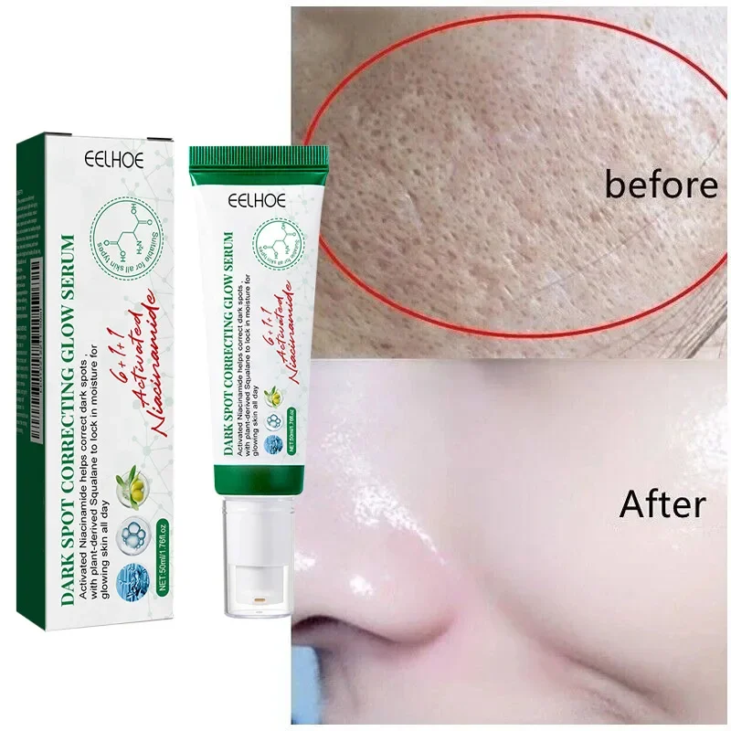 Facial Serum Dark Spot Correcting Glow Moisturizing Brightening Whitening Cream Reduce Freckles Dullness Acne And Melanin