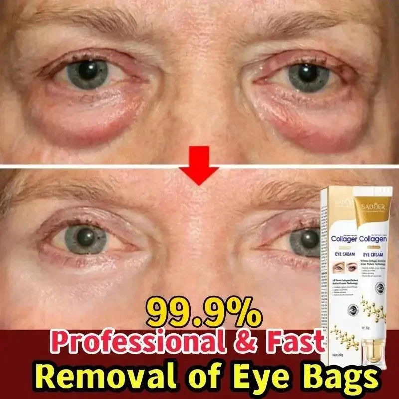 

Instant Eye Bag Remove Cream Collagen Removal Wrinkles Fade Fine Lines Anti-wrinkle Brighten Dark Circle Anti Puffiness Eye Care