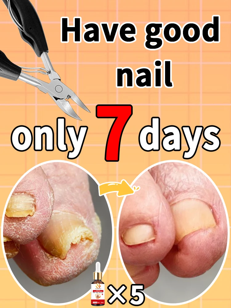 latest effective hawkbill nail clippers, remove ingrown nail, solve thick nail and help oil absorption