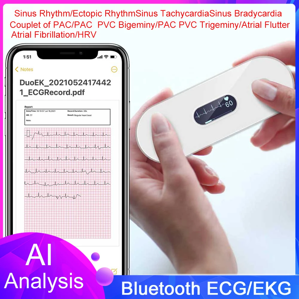 

Bluetooth ECG With Screen Charge Holter OLED EKG Heart Health Monitor Hand Held Mini EKG Monitor Unlimited Storage Share Report