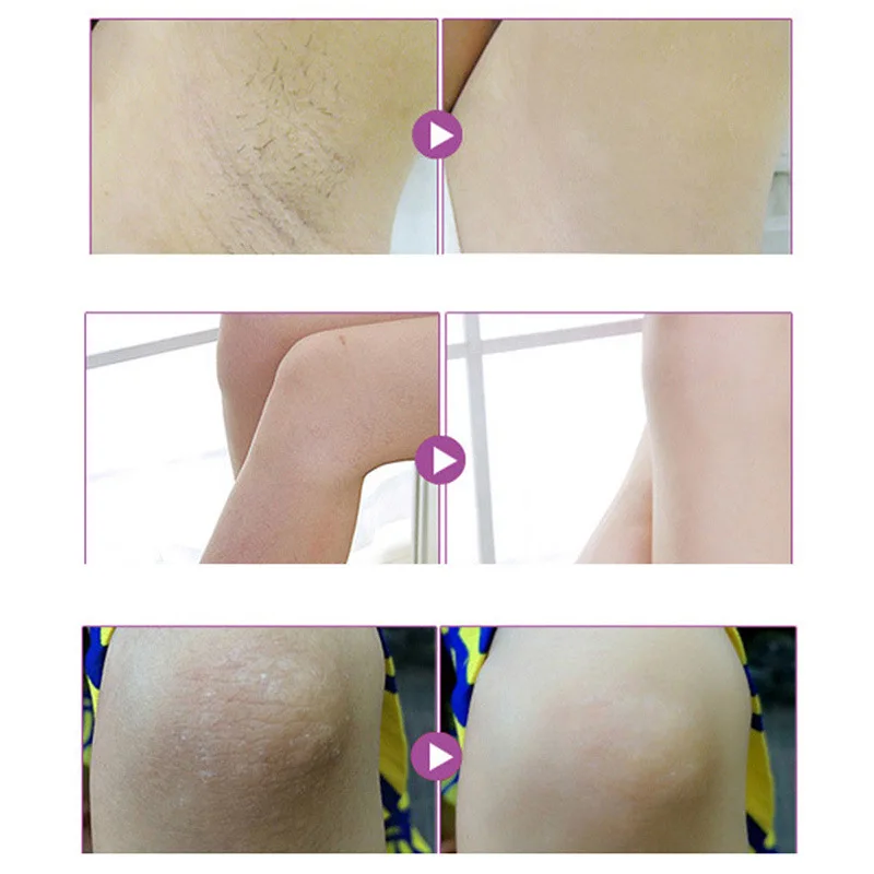 Whitening cream 3Days Armpit Whitening Cream Skin Lightening Bleaching Cream Underarm Dark Skin Legs Knees Whitening Intimate Body Lotion whitening body cream body lotion brightening cream body care brightening body cream body skin care cream