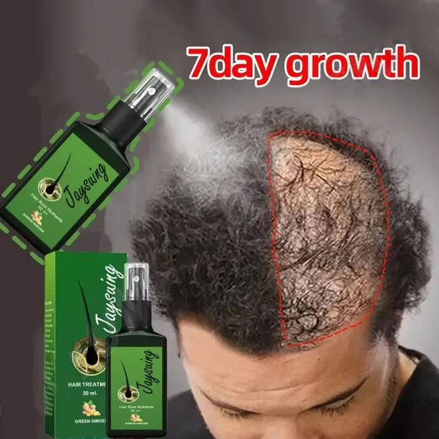 hair growth serum spray for anti hair loss treatment
