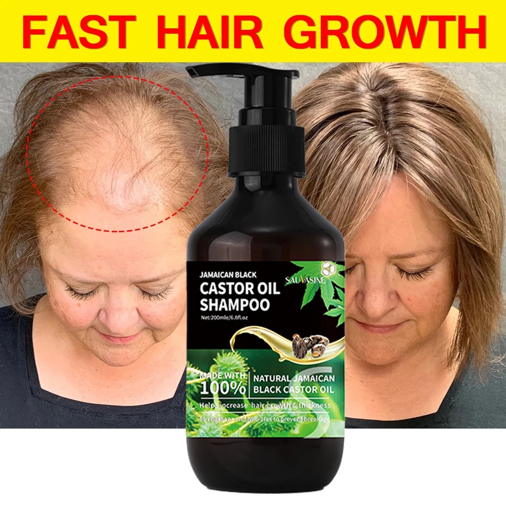 200ML Hair Growth Shampoo Jamaican Castor Oil Shampoo Quickly Strengthen Hair Roots Anti Hair Loss Products For Men For Women