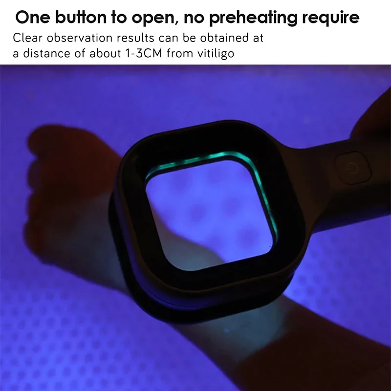 Handheld Woods Lamp 365nm UV Light Skin Fungus Detector for Cat Dog Ringworm Vitiligo Pityriasis Versicolor Home Use Diagnosis