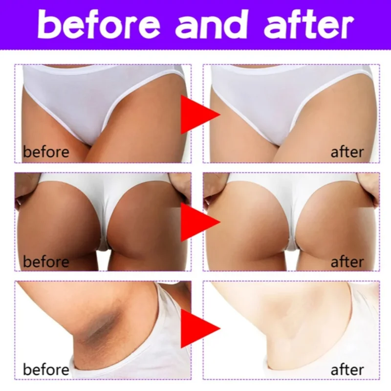 MAYCHEER Body Whitening Darkening Cream Underarms Arms Knees Darkening Moisturising Fine Skin whitening body cream whitening cream body lotion moisturising lotion brightening cream brightening body cream body care body skin care cream underarm cream