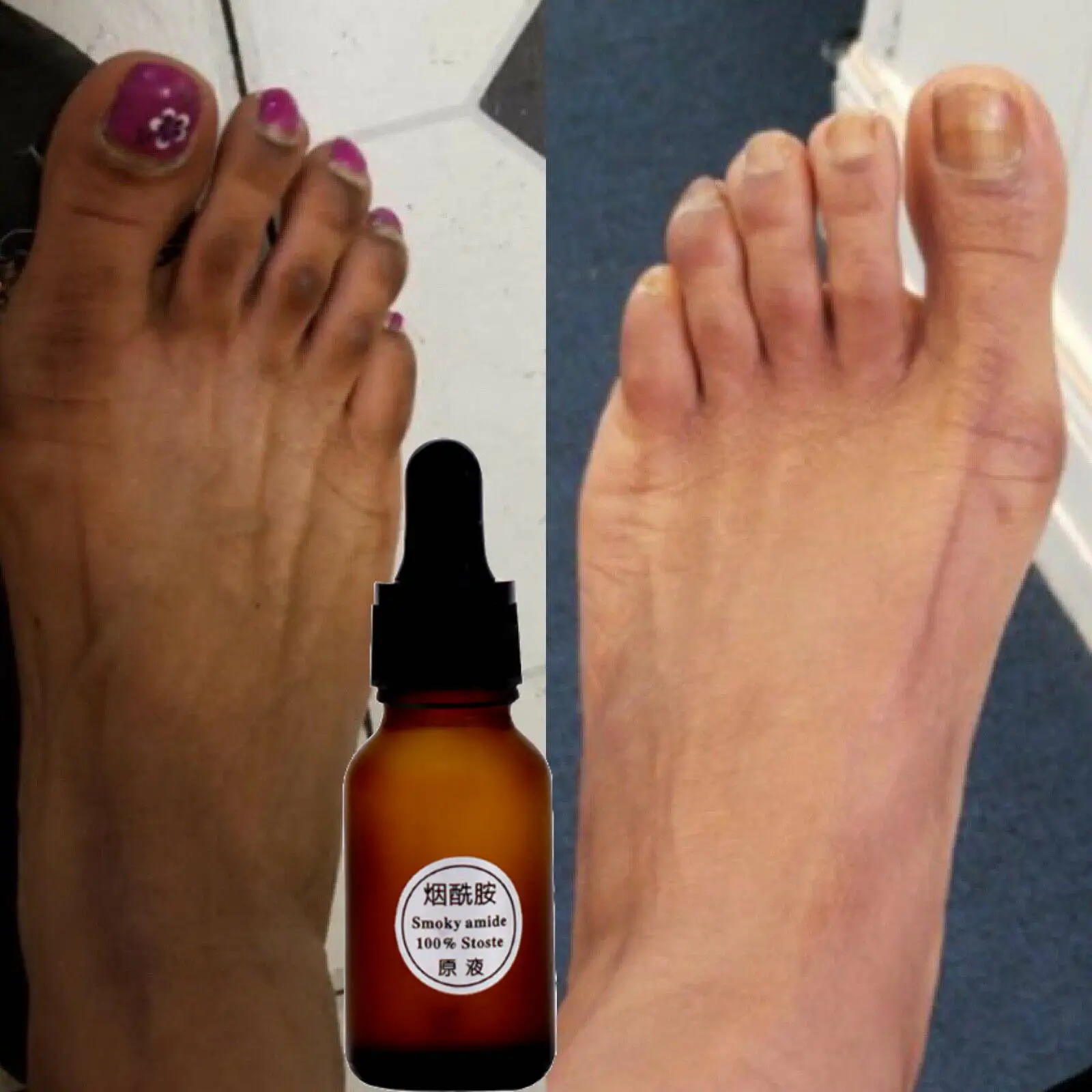 DarkFeetIntenseWhiteningOilCreamNaturalLightInstantDarkKnucklesDarkFeetHandRemover