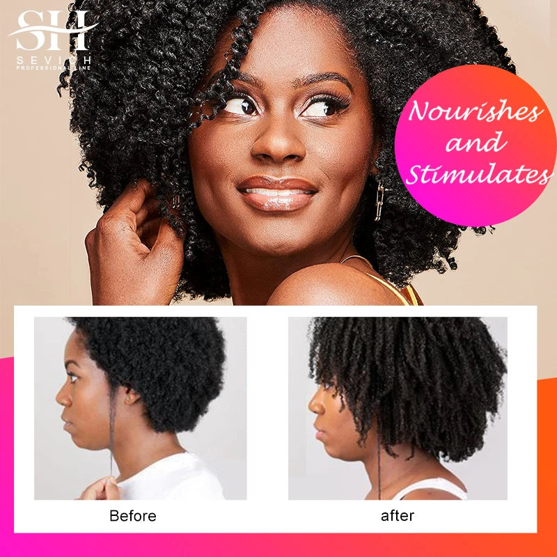 Sevich Chebe Powder Effective Growthing Hair Improves Hair Density Nourishes Follicles Fast Regrowth Product 100g