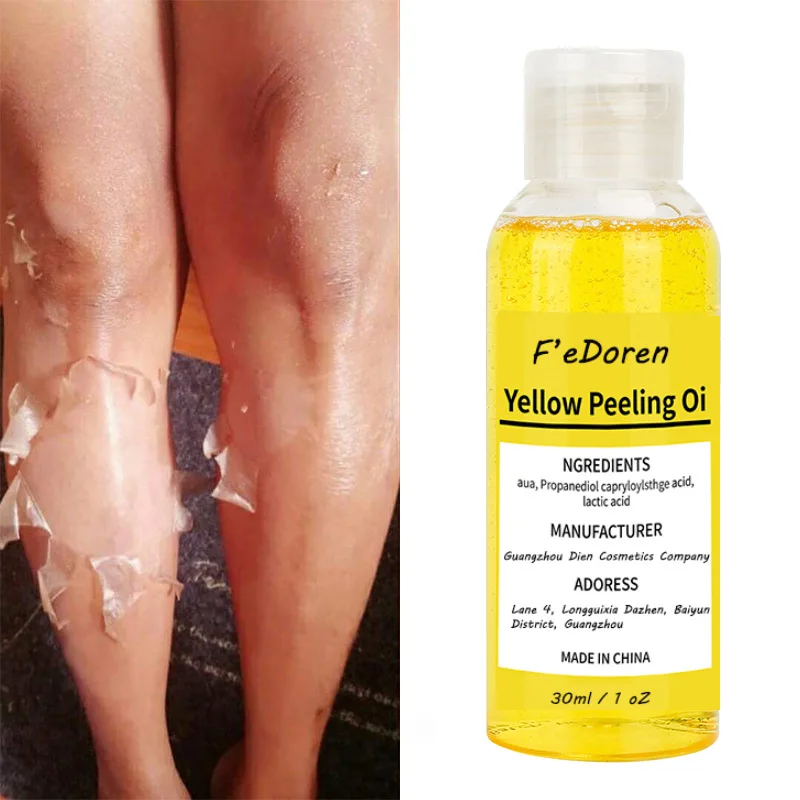 yellow peeling oil