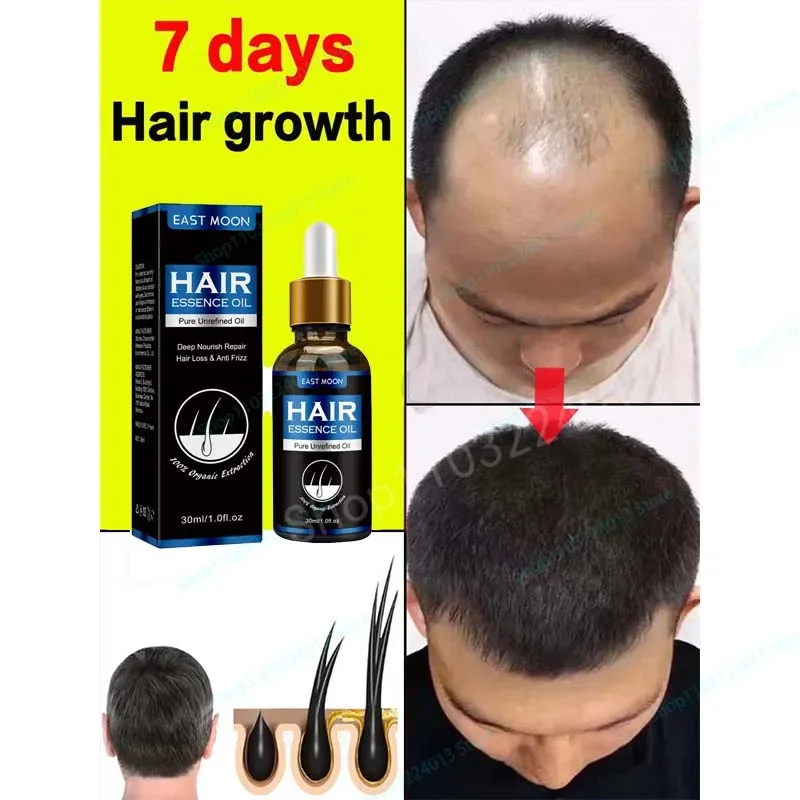 

Средство для ухода за волосами, распылители для утолщения волос, продукты для роста для женщин и мужчин, быстрое Уход за волосами, эфирное масло