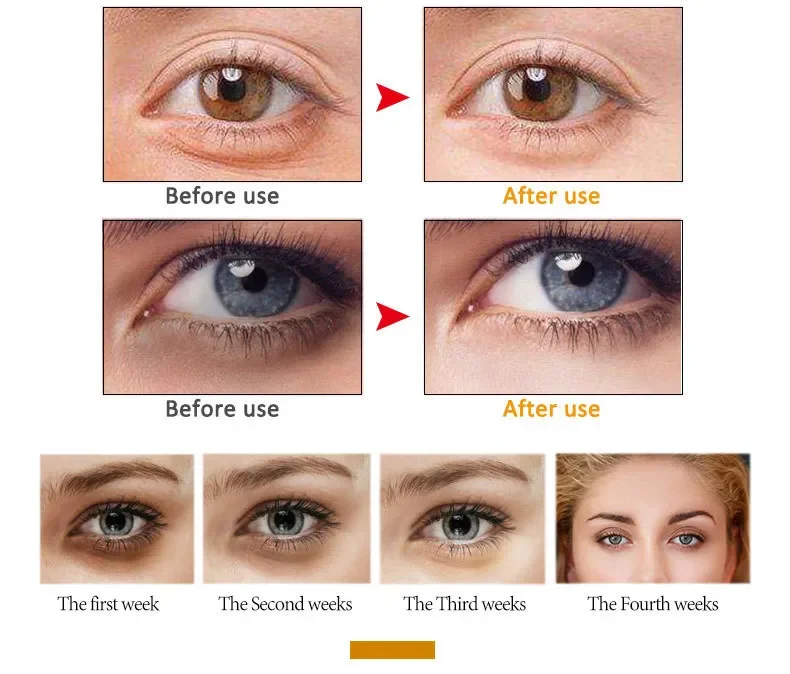 S8e379712cf674246a403fe6cf9d820f25 Peptide Nourishing Anti Wrinkle Eye Serum Anti Dark Circle Eye Bags Puffiness Lifting Firming Skin Roller Massager Eye Care