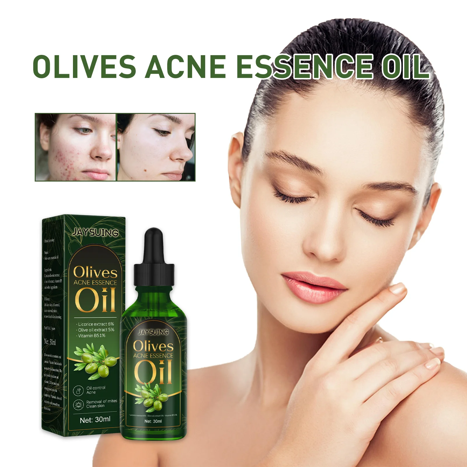 

Экстракты растений против акне, удаление шрамов, контроль пятен, уменьшение пор, отбеливание и увлажнение