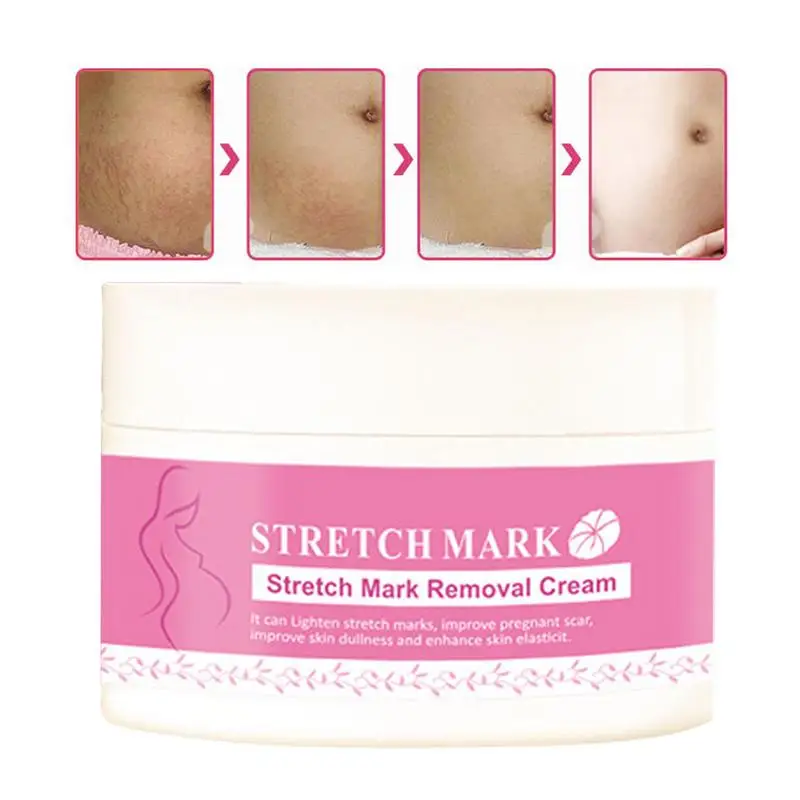 

Stretch Mark Cream Stretch Mark Remover 1.05 Oz Skincare Body Moisturizer Non-Greasy Hydrating Essence For Most Skin Types