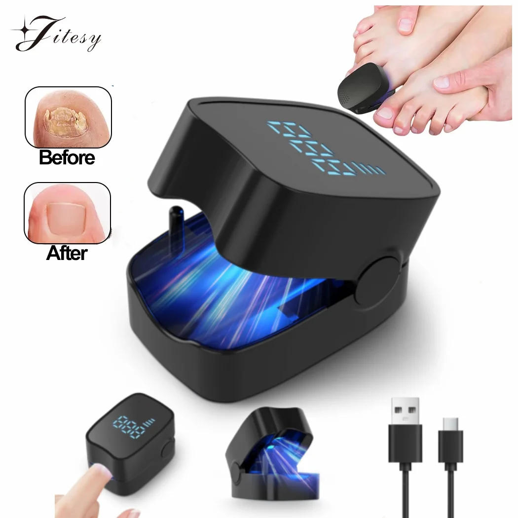 Nail Fungus Laser Treatment Device for Cleaning Onychomycosis Digital Display 905nm Infrared Light 470nm Blue Light Nail Salon nail fungus remover,personal health care,laser therapy pen