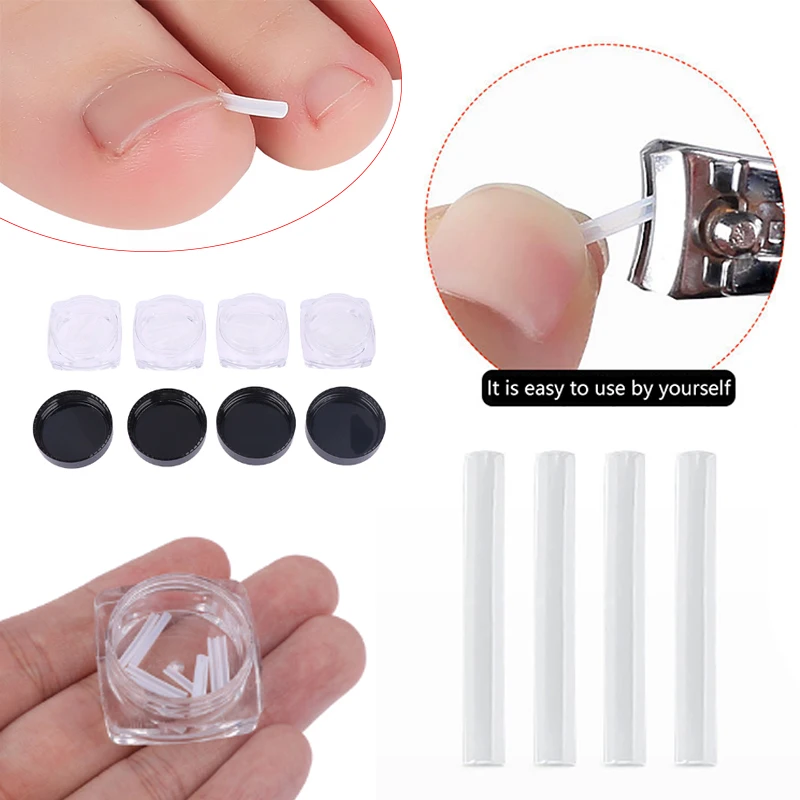 

10/20/30/50Pcs Nail Correction Stickers Ingrown Toenail Corrector Patches Paronychia Treatment Recover Corrector Pedicure Tools