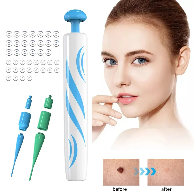 Mini Practical Simple Operation Lightweight Mole Wart Remover Equipment Micro Treatment Tool Skin Tag Remover Skin Care simple lightweight anti corrosion rubber single water feed motor flusher outboard motor flusher practical