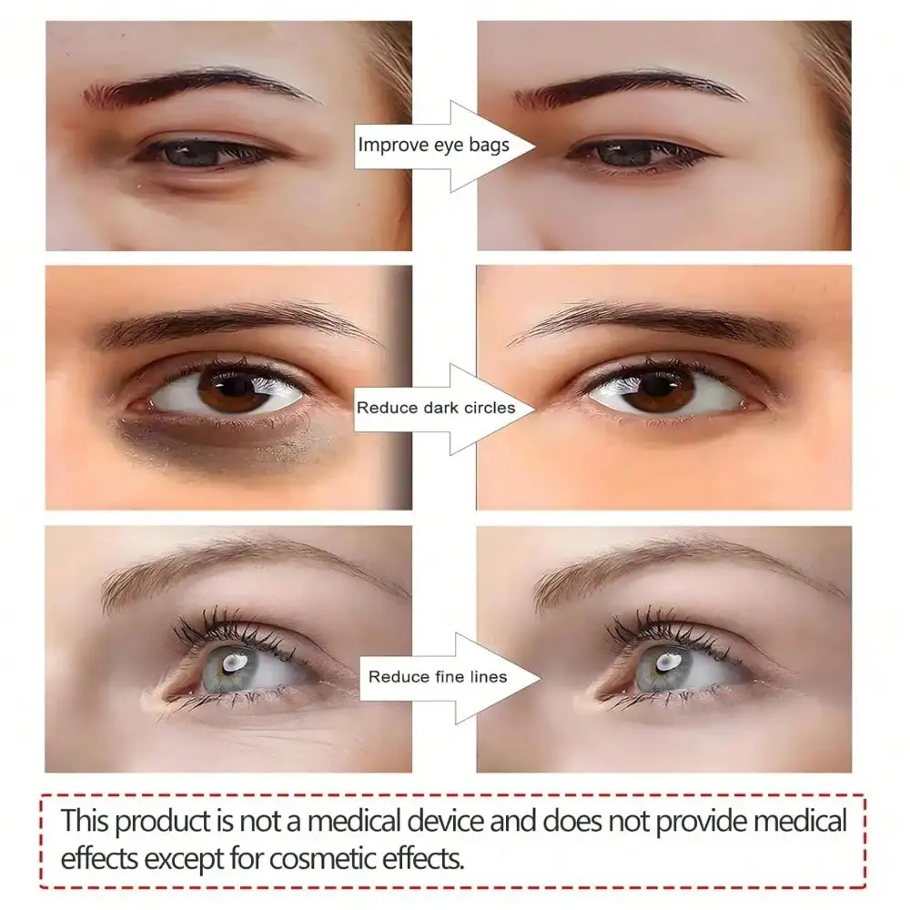 3D EMS Eye Beauty Instrument Micro-Current Pulse Eye Relax Reduce Wrinkles And Dark Circle Remove Bags Massager Beauty Tool