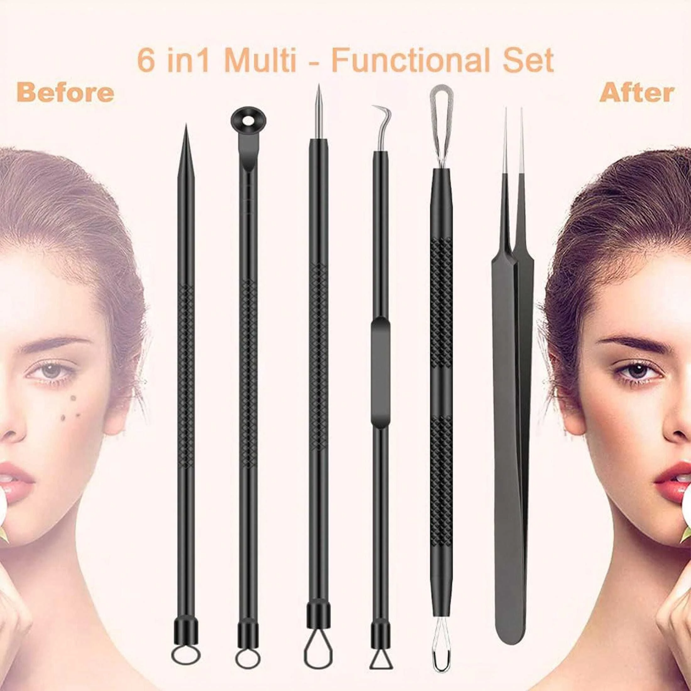 Acne Removal Tool Set 6