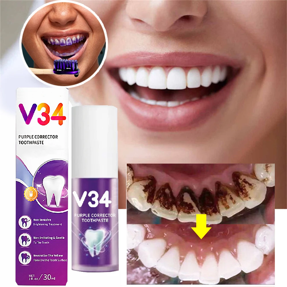 Mousse de soin dentaire, Essence, élimine la Plaque dentaire, réparation gingivale, prévention des caries, nettoyage buccal, 30m_voghion.com