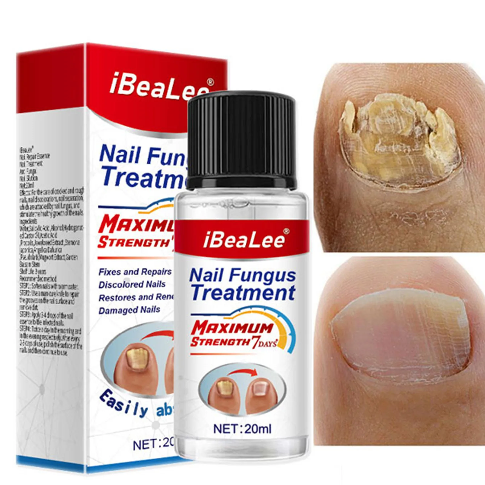 

Nail Hardener 20ml Gentle Nail Repair Solution Repair Weak Brittle Thin Damaged Nails For Yellowing Turbidness Discoloration