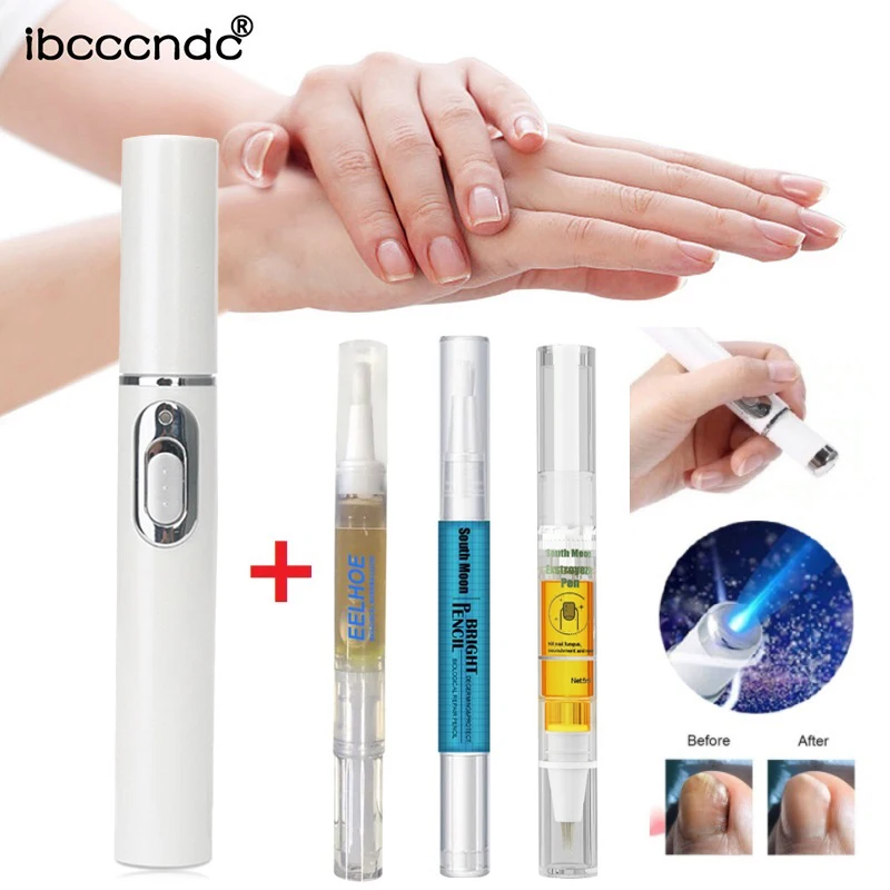 

Onychomycosis Laser Pointer Nail Repair Pen With Nail Fungus Nail Oil Pen Anti Fungal Cuticle Remover (Without Battery)