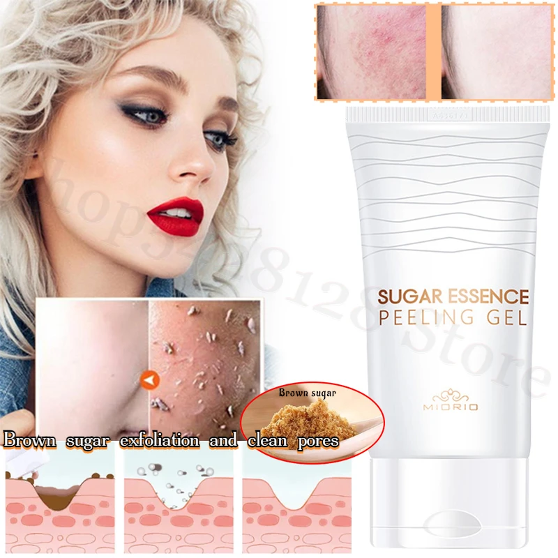 MIORIO Brown Sugar Exfoliating Gel Improves Dry Skin, Facial Female Body Exfoliates Deep Cleansing Pores Gel 150ml