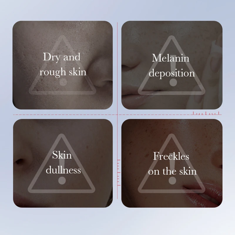 SADOER Kojic Acid Whitening and Freckle Removal Cream Moisturizing Facial essence Anti-Aging Face Serum Skin Care Products