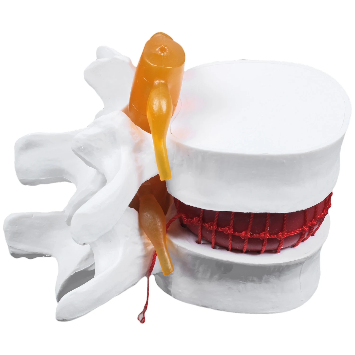 

Human Anatomy Skeleton Spine Lumbar Disc Herniation Teaching Model Brain Traumatic School Supplies Instrume