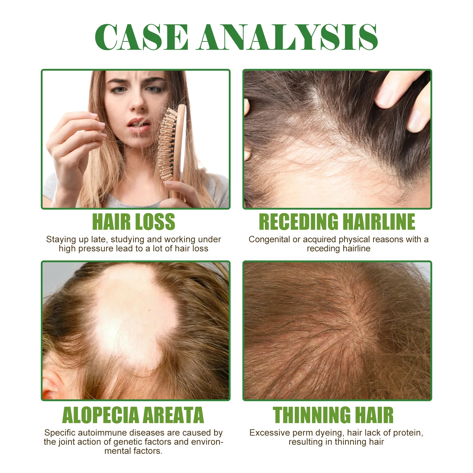 Rosemary Scalp Hair Essential Oil Softens Nourishes Hair Repairs Damage Prevents Loss And Nourishes Essence Oil