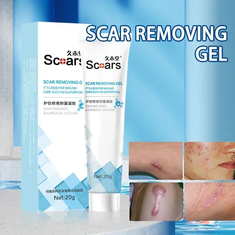 Scar Removal Herbal Cream Repair Stretch Marks Treatment Gel Burn Acne Surgical Acne Scar Ointment Whitening Beauty Health Care