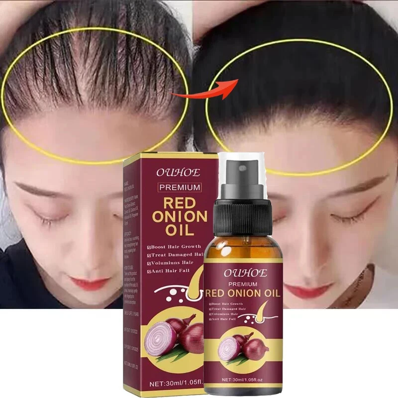 Powerful Hair Growth Serum Spray Anti Hairs Loss Treatment Essential Oils Repair Nourish Roots Regrowth Hair Care Beauty Health