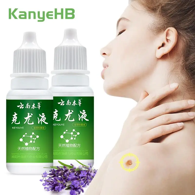 

2Pcs Warts Remover Antibacterial Liquid Wart Skin Tag Remover Genital Herpes Papillomas Treatment Herbal Medicine Liquid A1088