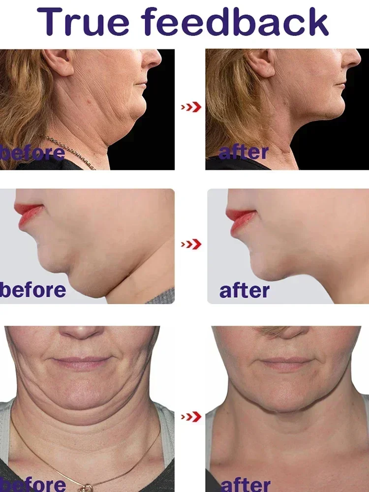 Skinny Face Cream V Series Double Chin Remover