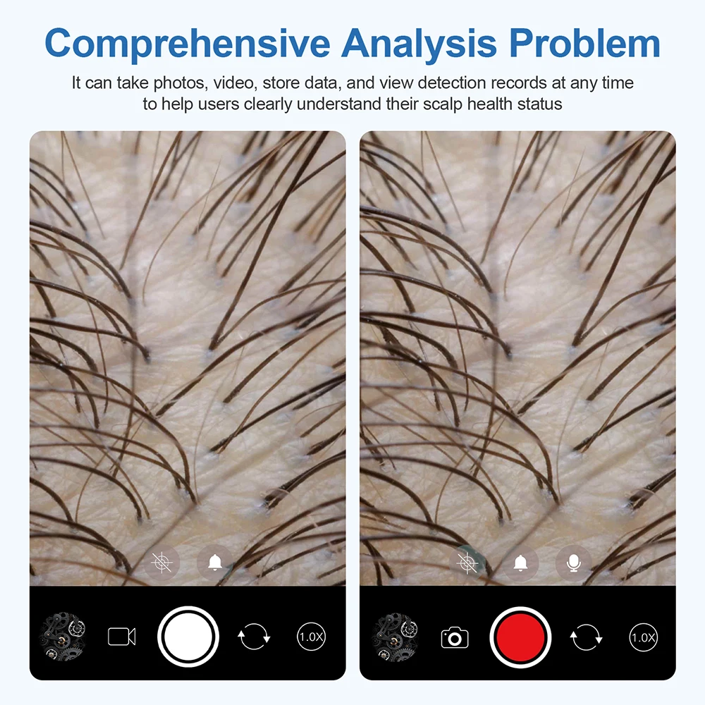 500W HD Skin Analyzer Hair Follicle Detector Scalp Tester Analysis Microscope 1 Million Pixel For Diagnosis Skin Care Tools