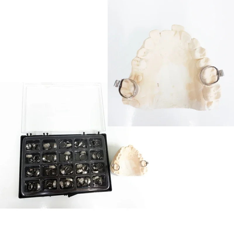 Fasce Presaldate Tubo Orale Ortodontico Dentale Rosso 022 1 - Foto 3