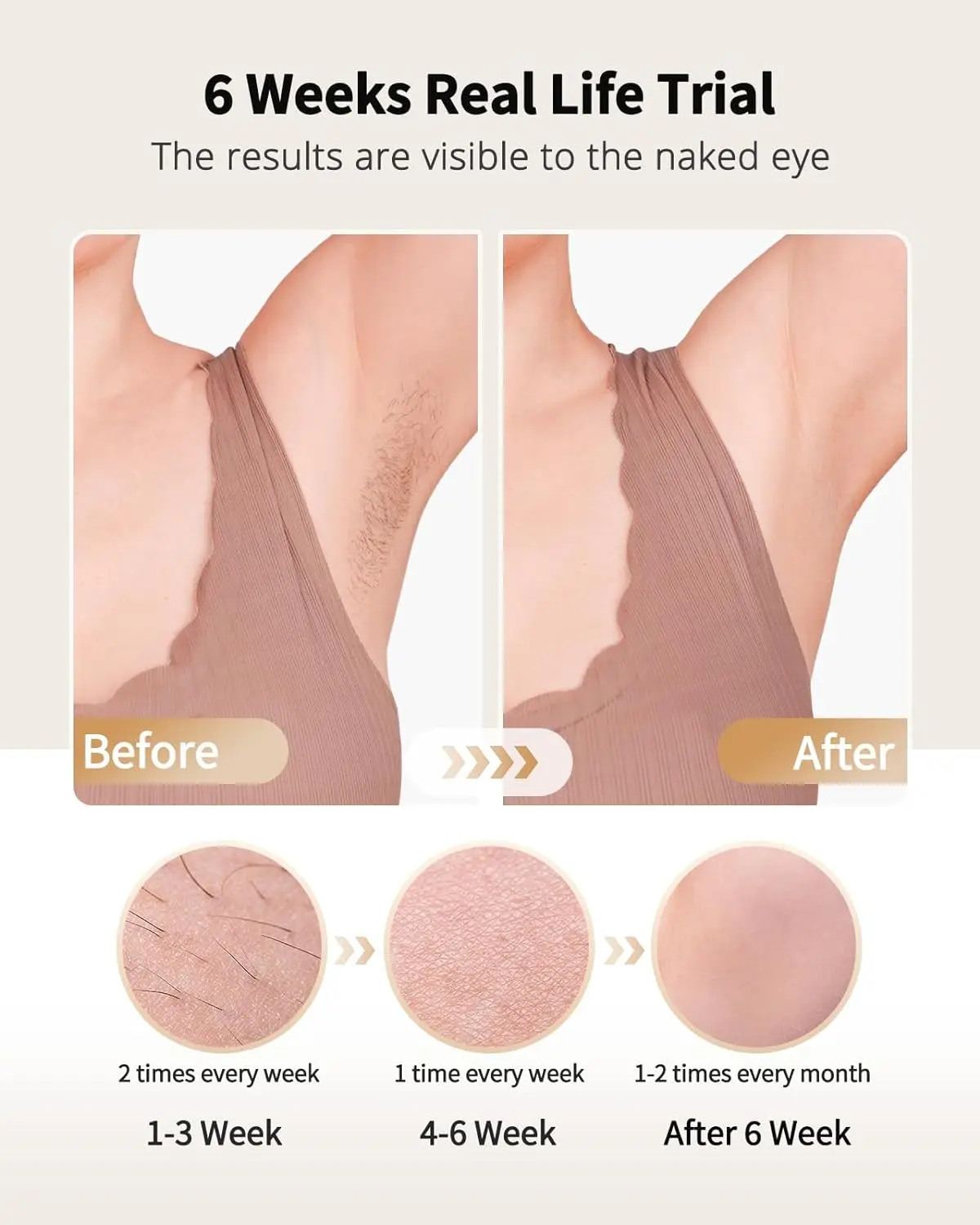 Laser Hair Removal with Ice Cooling Care Function for Women Men Permanent,Unlimited Flashes Painless Epilator IPL Hair Remover 4