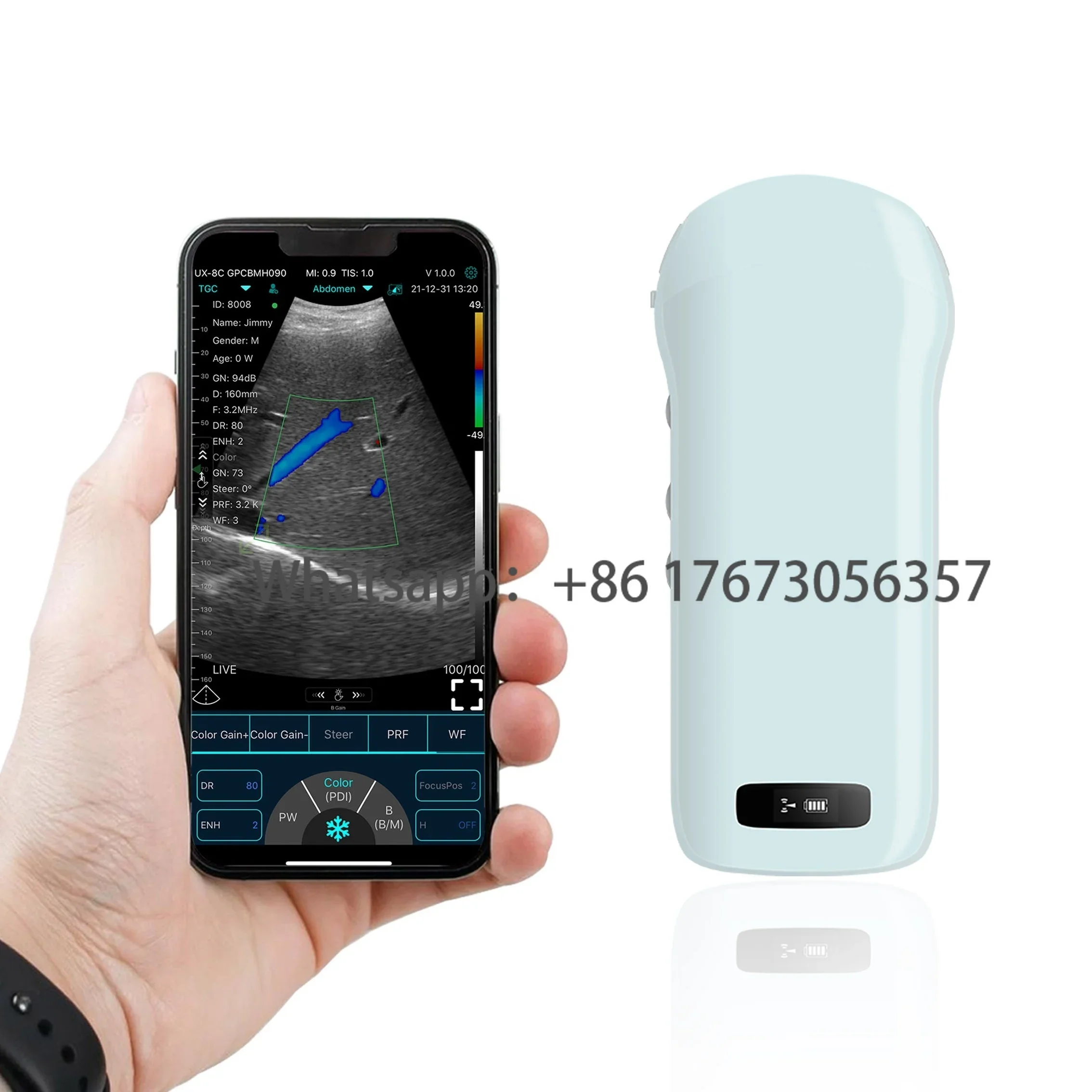 Equipo Maquina De Doppler Ultrasonido Lineal Wifi Portatil Convexo Ultrasonido 3 En 1