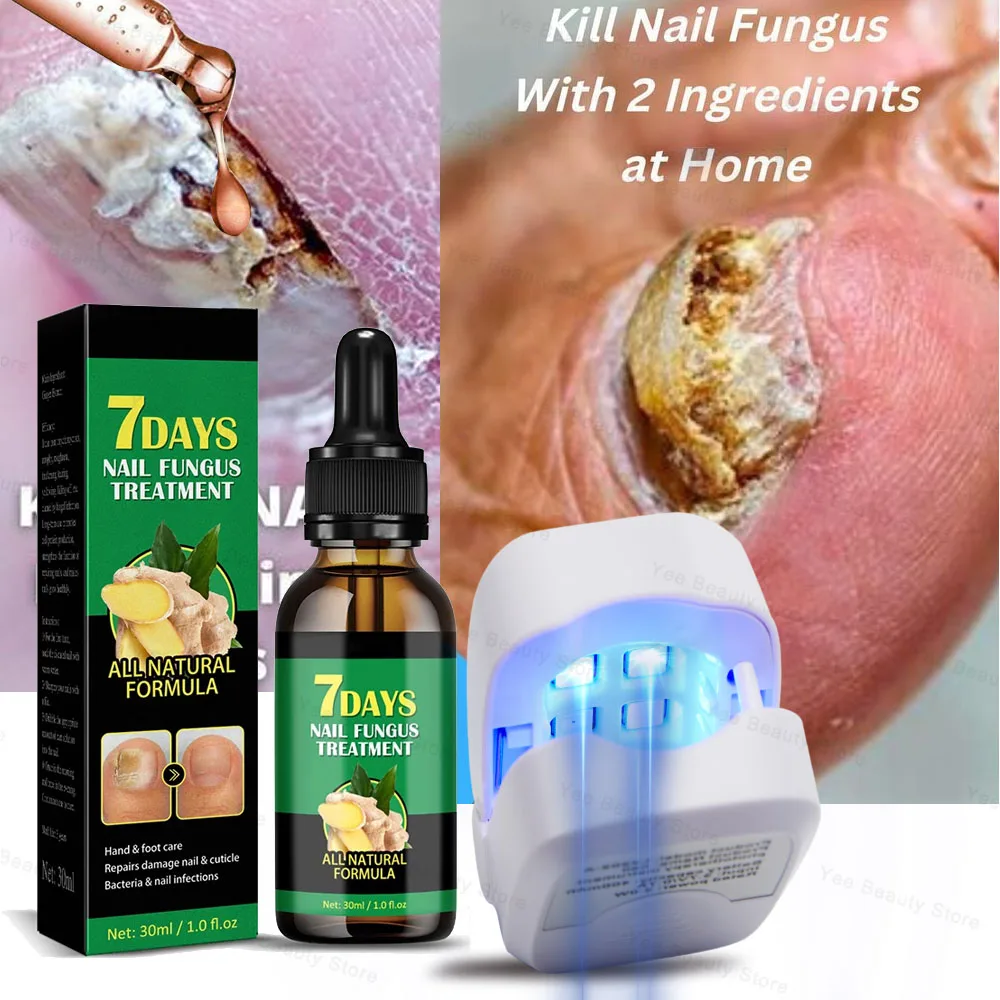 Fungal-Nail-Treatment-Essence-Oil-Nail-Fungus-Laser-Device-Repair ...