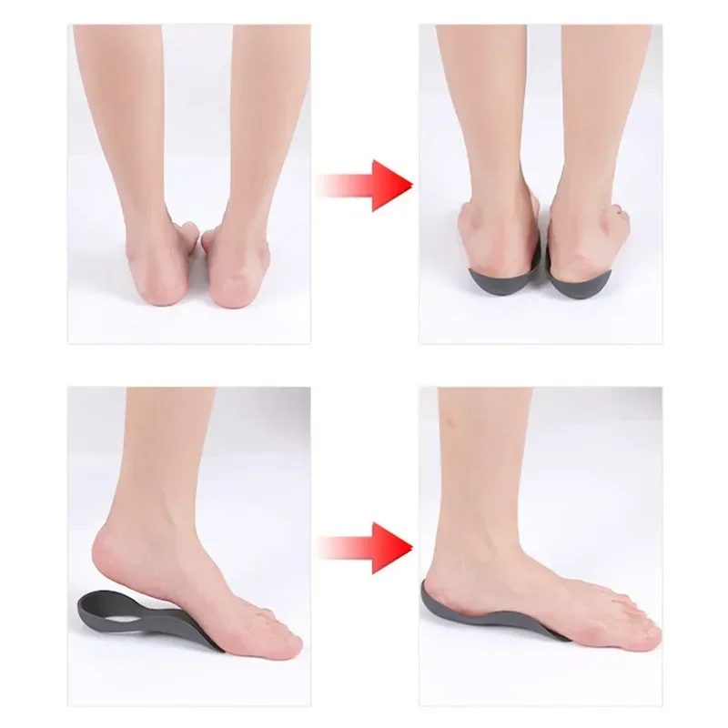 XO-Legs Orthopedic Insoles for Shoes Arch Support Plantar Fasciitis