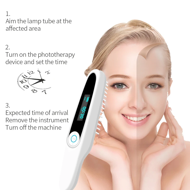 Vitiligo Therapy Device Psoriasis Skin Treatment Light 311nm Narrowband Ultraviolet Phototherapy Instrument UVB Lamp 3