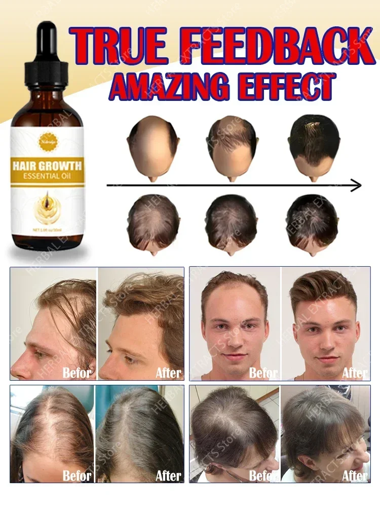 Essential oils that promote rapid hair growth and treat baldness and hair loss 3
