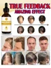 Essential oils that promote rapid hair growth and treat baldness and hair loss 3