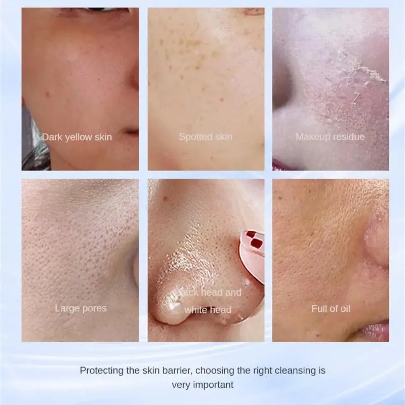 120g Facial Cleanser Whitening Moisturizing Freckle Removal Deep Cleansing Foam Dense Gentle Cleanser Face Skin Care